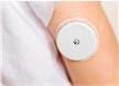 Glucomètres en continu (CGM)